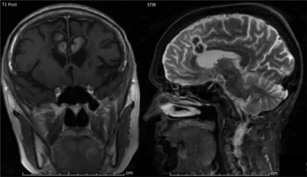 Fig 5.