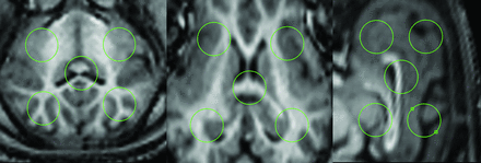 Fig 1.