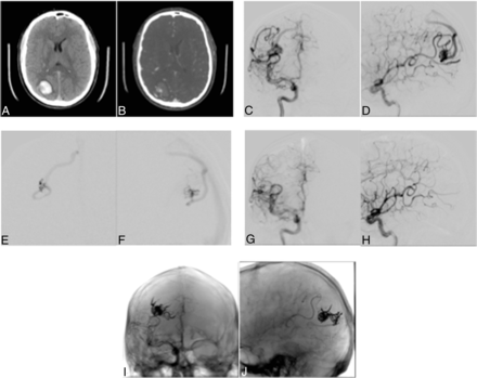 Fig 1.