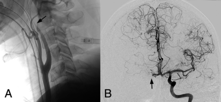 Fig 1.