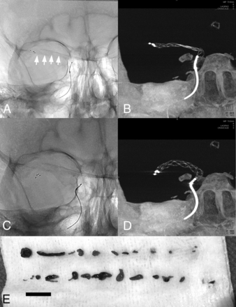 Fig 2.