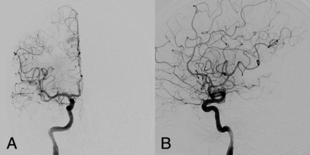 Fig 3.