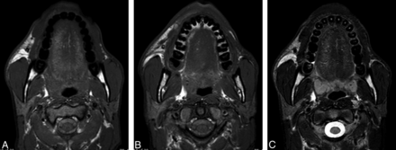 Fig 3.