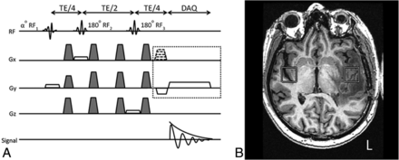 Fig 1.