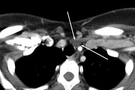 Fig 1.
