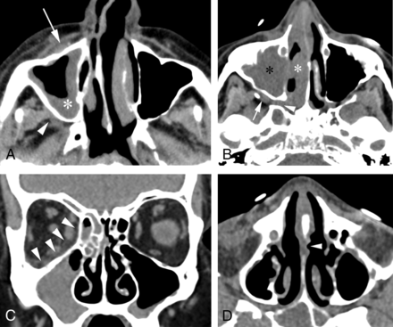 Fig 2.