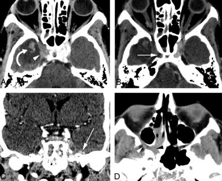 Fig 4.