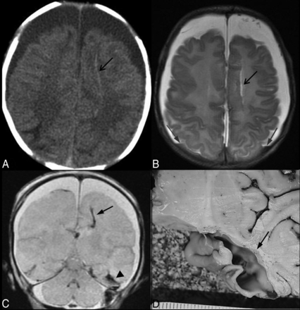 Fig 3.
