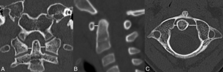 Fig 1.