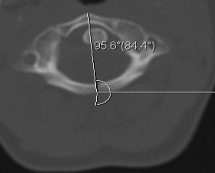 Fig 2.