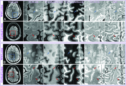 Fig 3.