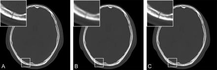 Fig 1.
