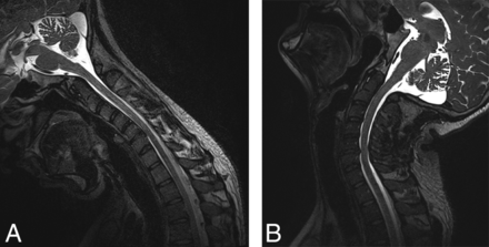 Fig 1.