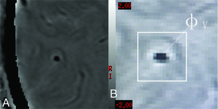 Fig 2.