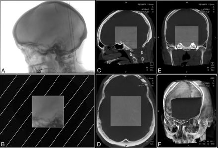 Fig 1.