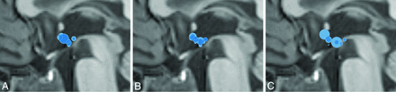 Fig 2.