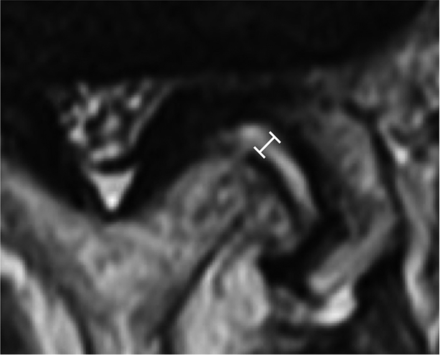 Fig 2.