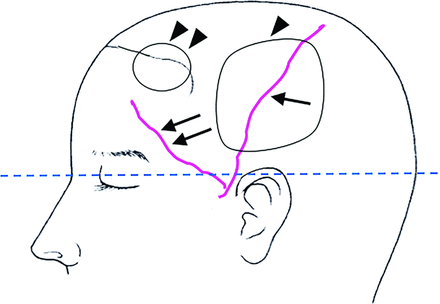 Fig 1.