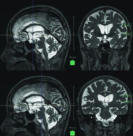 Fig 1.