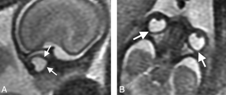 Fig 3.