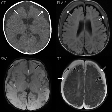 Fig 1.