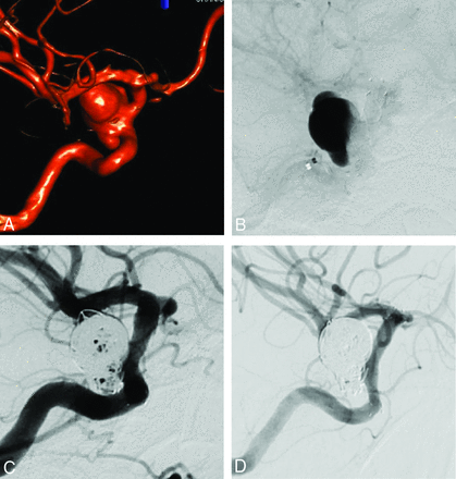 Fig 3.