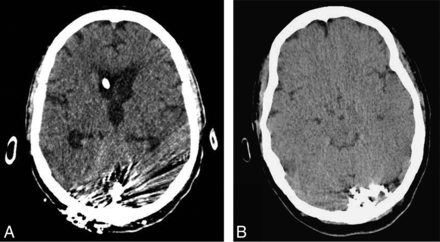 Fig 3.