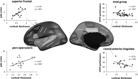 Fig 2.