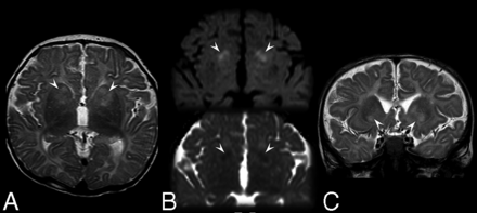 Fig 2.