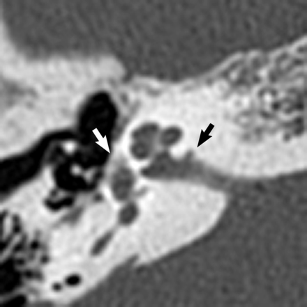 Fig 2.
