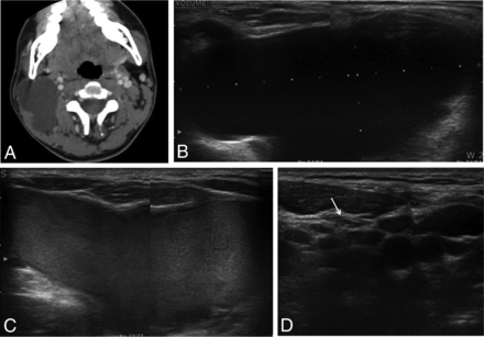 Fig 3.