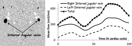 Fig 3.