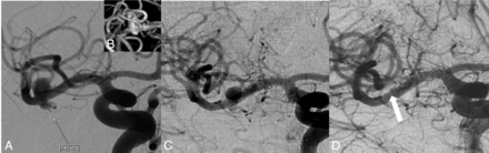Fig 4.