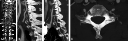 Fig 4.