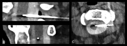 Fig 2.