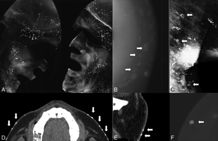 Fig 4.