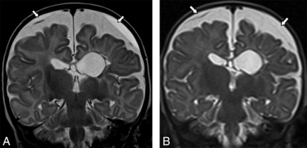 Fig 1.