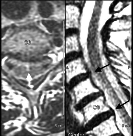Fig 3.