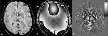 Fig 1.