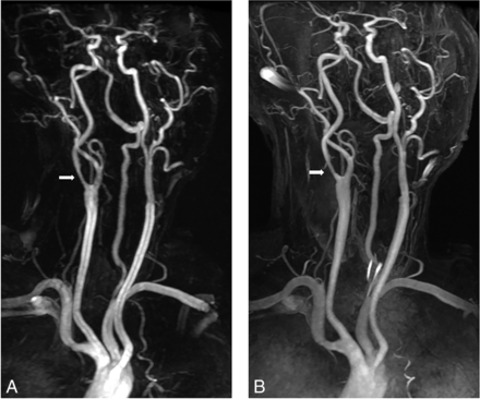 Fig 4.