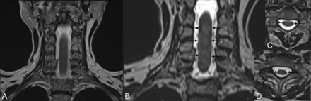 Fig 1.