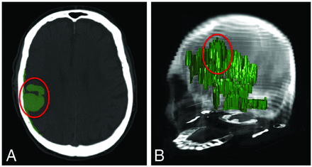 Fig 3.