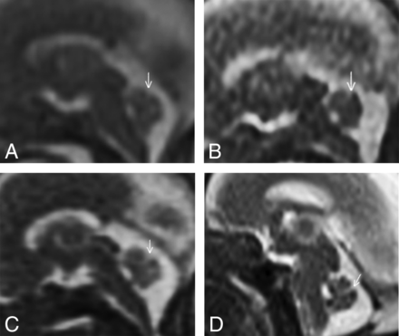Fig 1.