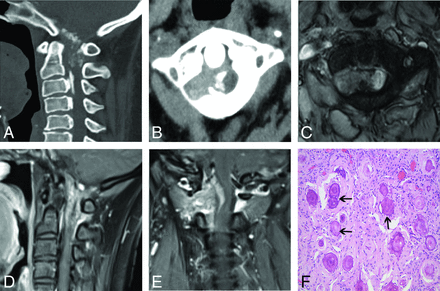 Fig 1.