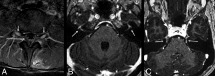 Fig 2.