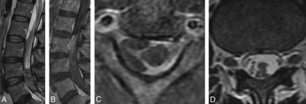 Fig 2.