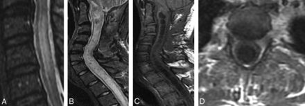 Fig 3.