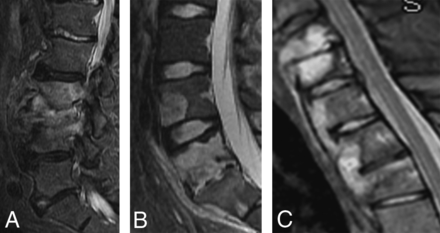 Fig 4.