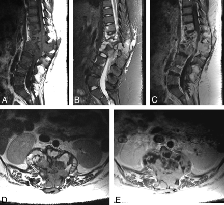 Fig 6.