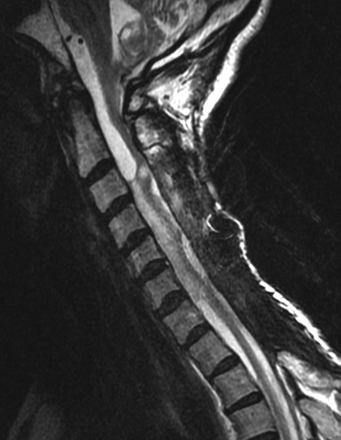 Fig 7.